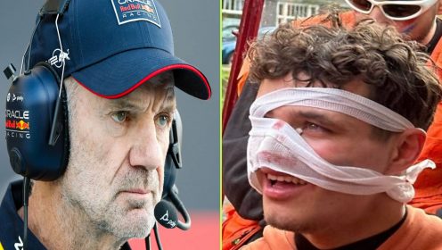 Lando Norris pictured with bandaged face as Adrian Newey salary figure noted – F1 news round-up