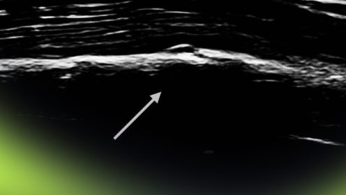 Oscar Piastri shares surprise F1 2024 injury with X-ray image revealed